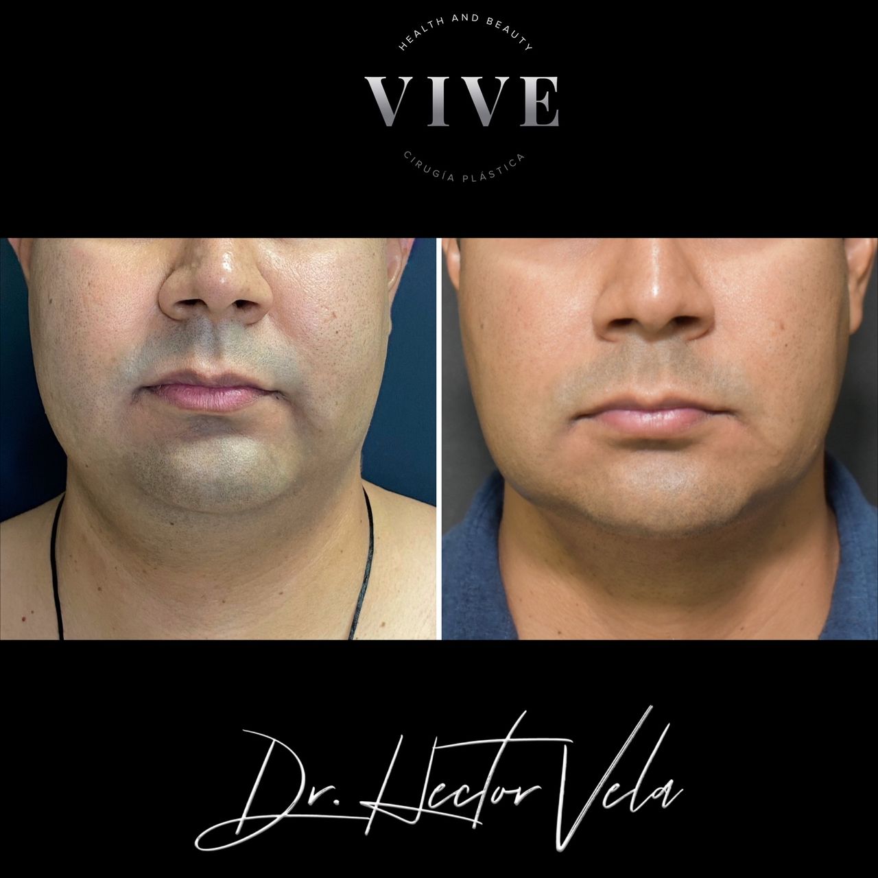 Héctor Eduardo Vela Cardona-196