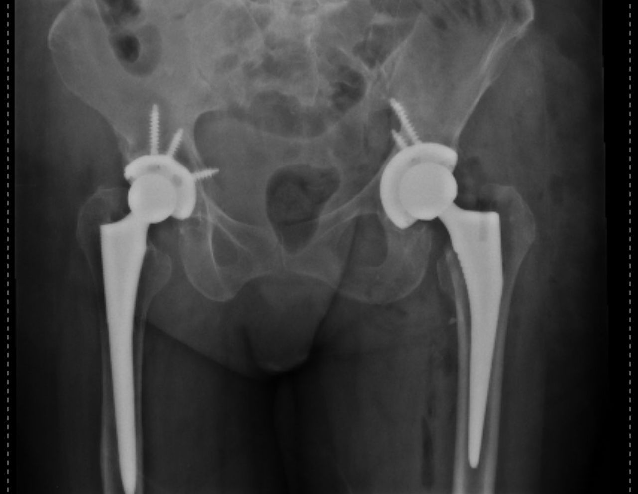 Cristian Ernesto Murillo Medina-4