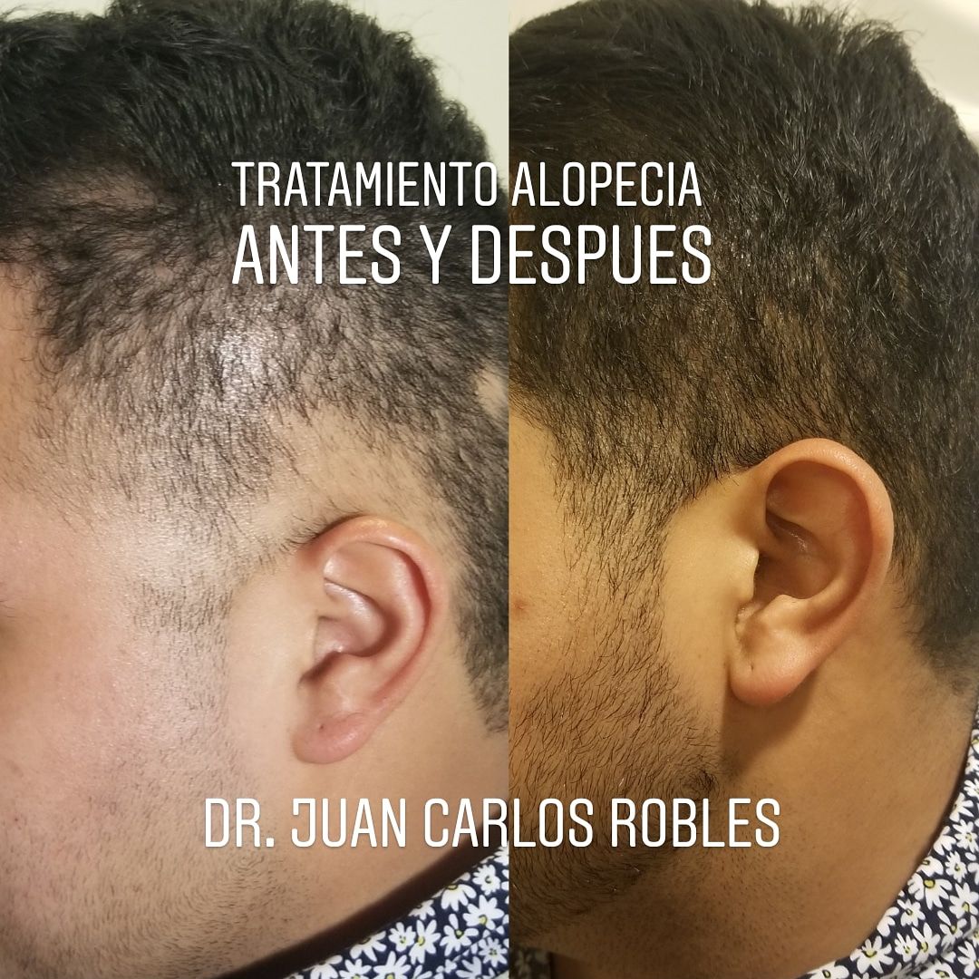 Juan Carlos Robles Méndez-29