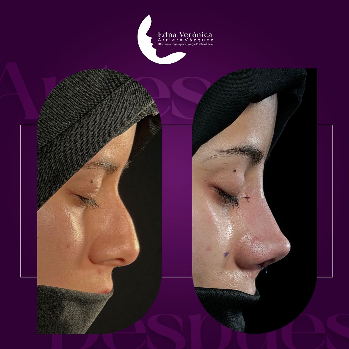 Edna Verónica Arrieta Vázquez-4