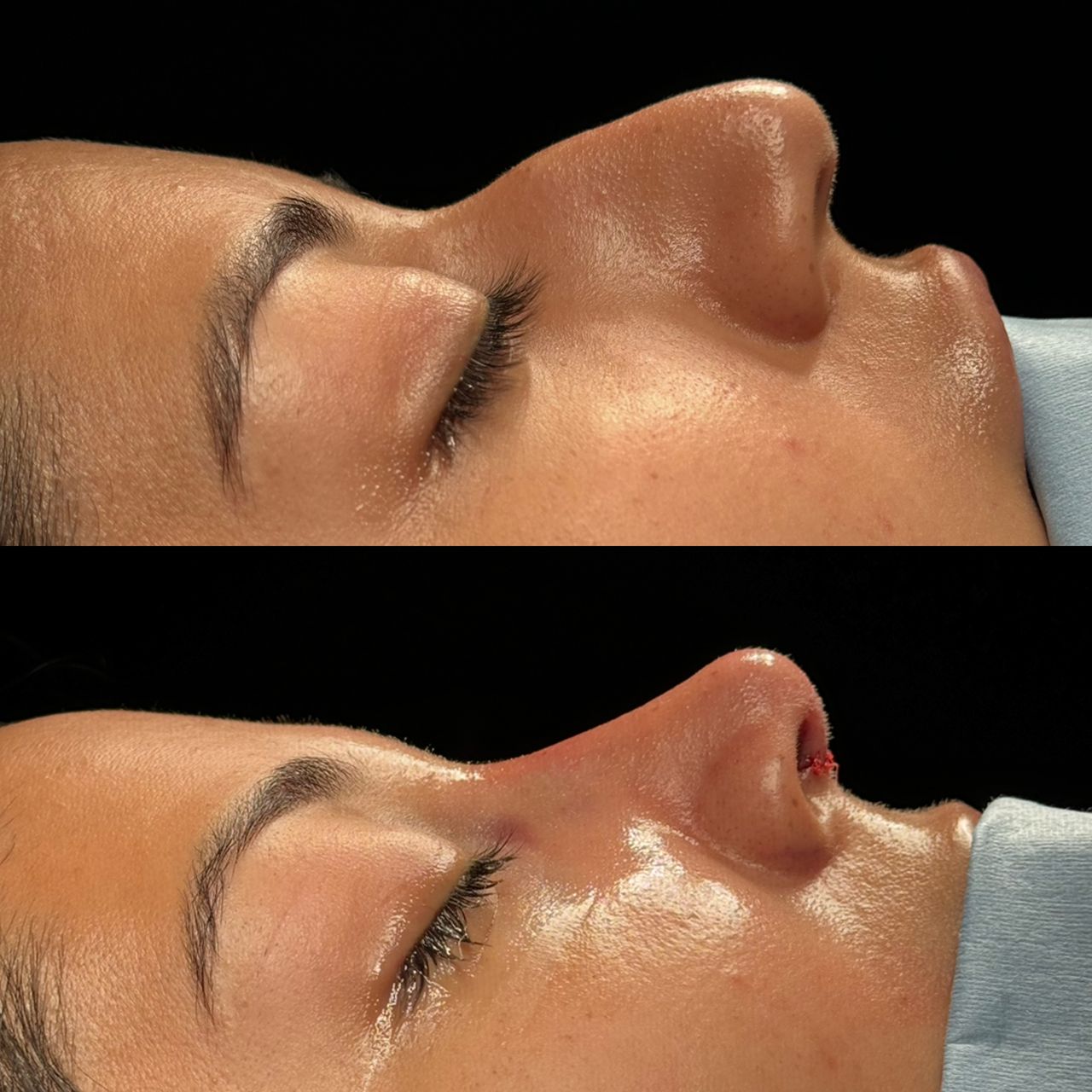 Angel Castro Urquizo-52