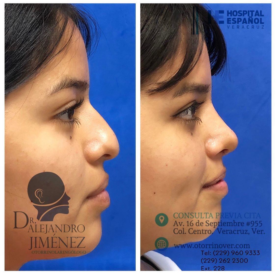 Alejandro Jimenez Garcia-4