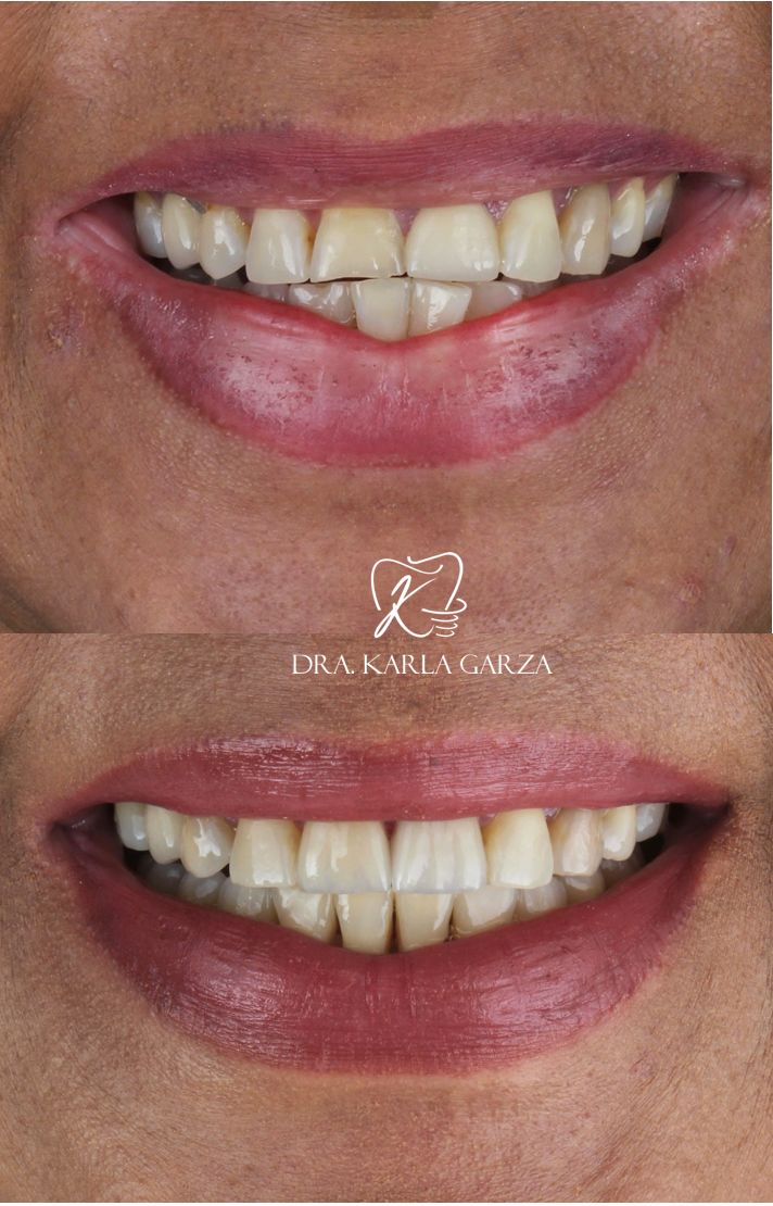 Karla Yaneth Garza Medina-2