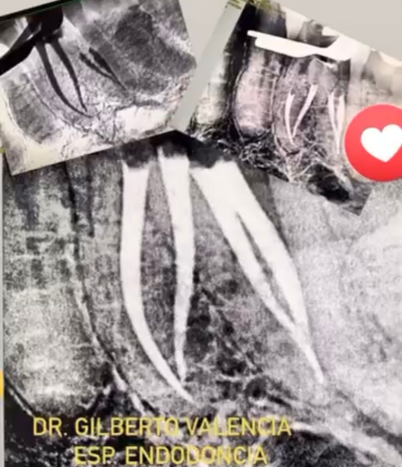 Gilberto Valencia Campos-0