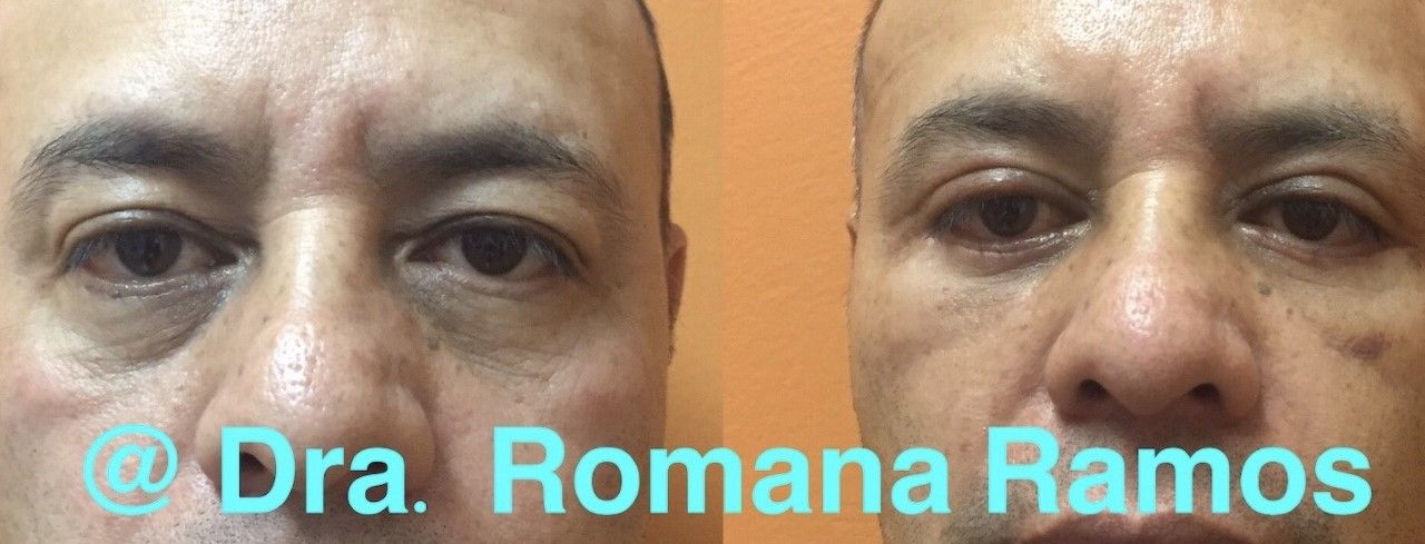 Romana Ramos Cárdenas-16