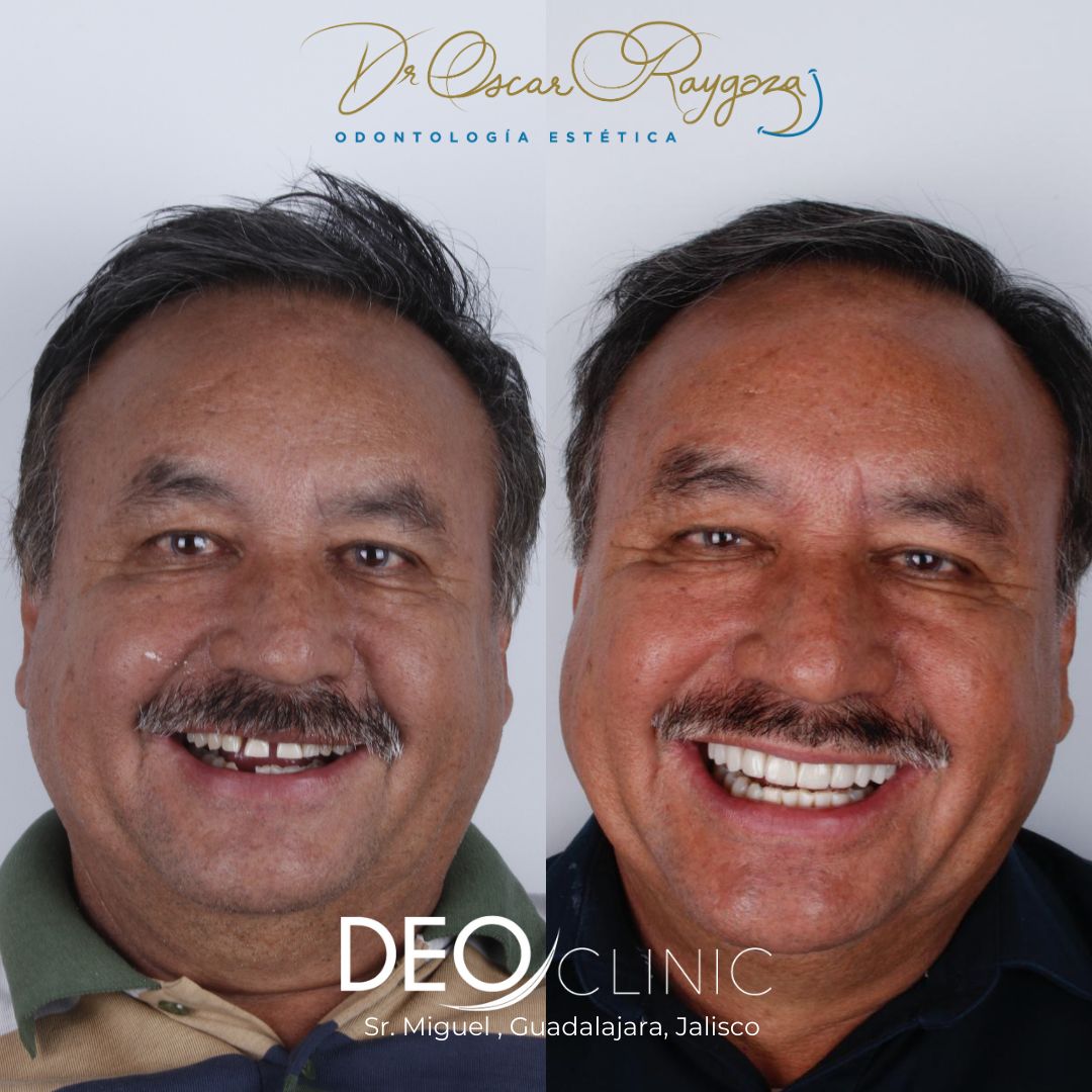 Oscar Raygoza Carrillo-42