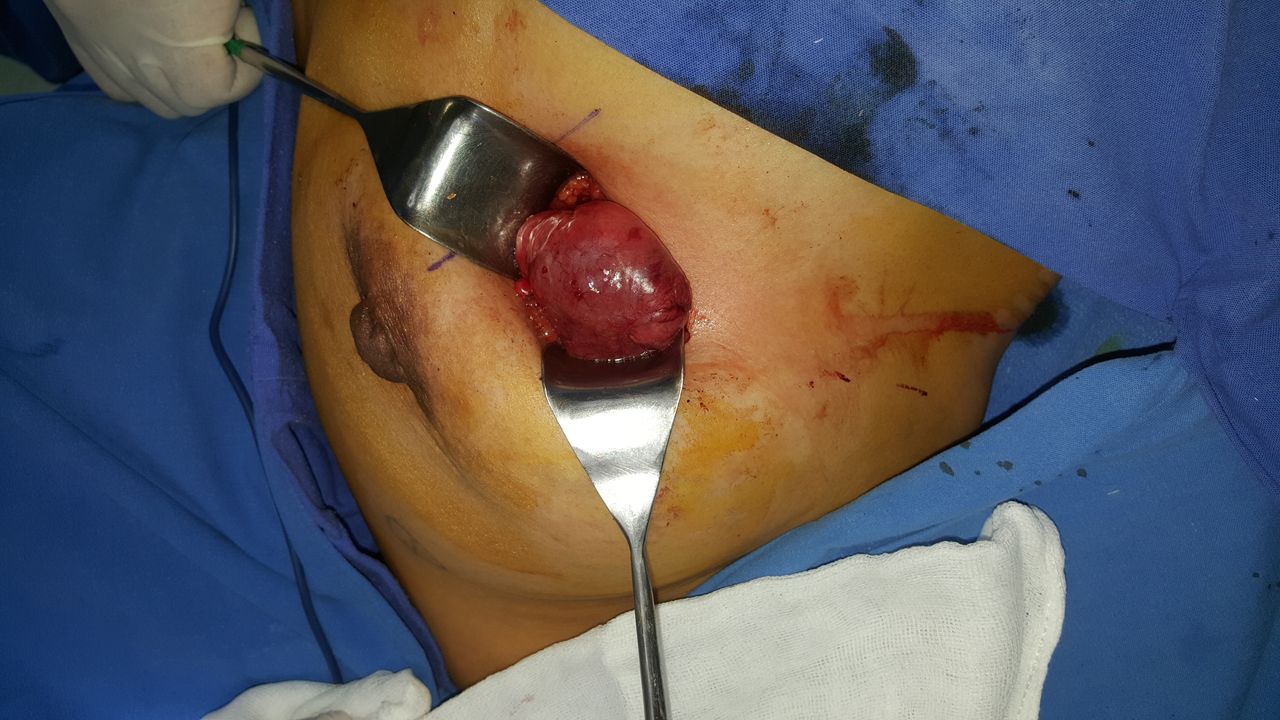 Ángel Millán Juárez-35