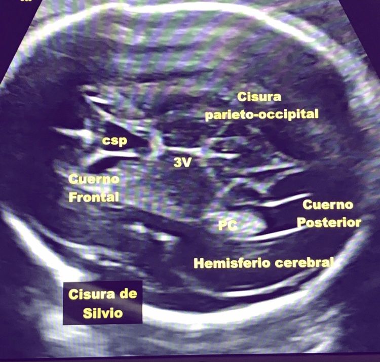 Issumi A. Meza Meneses-1