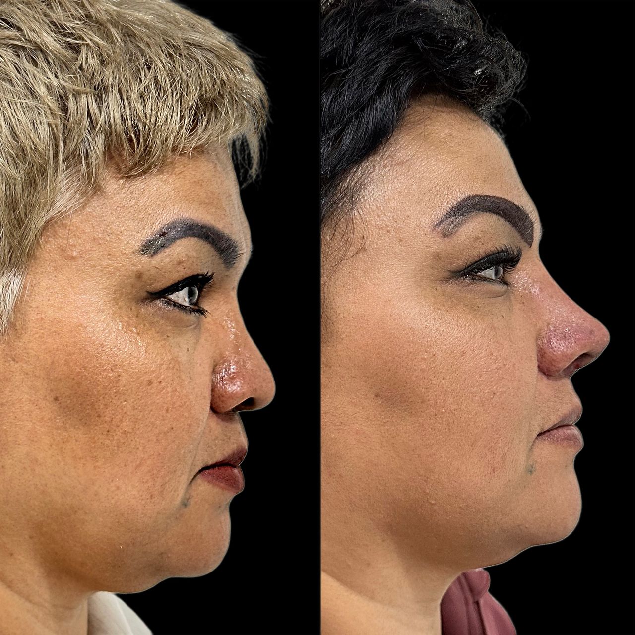 Ramiro Chávez Montoya-5