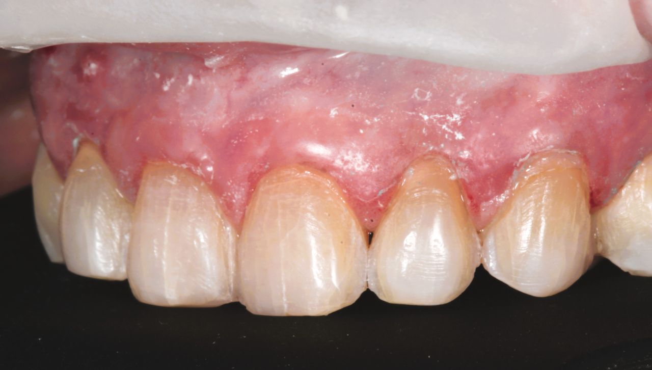 Mariel Itzayani Torres López-41