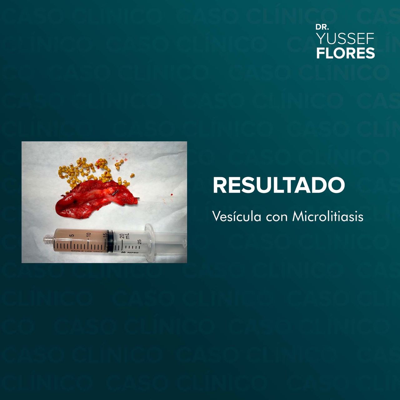 Yussef Flores López-8