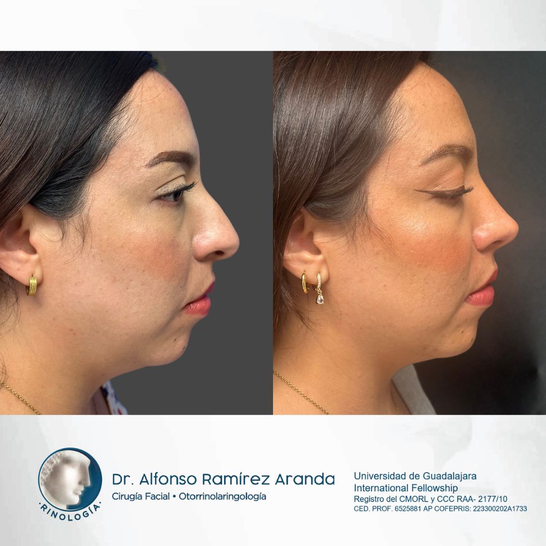 Alfonso Ramírez Aranda-14