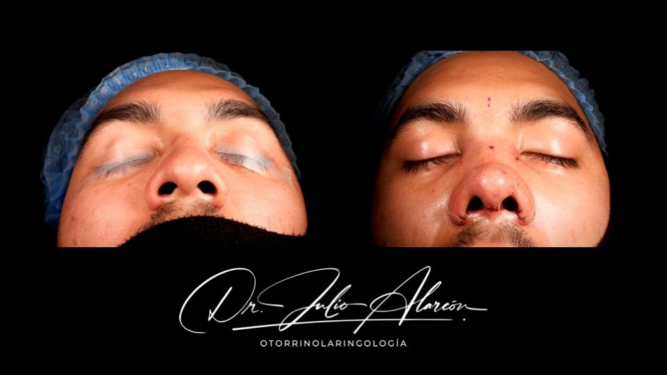 Julio César Alarcón Ortiz-7