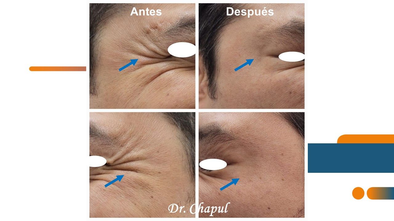 José Luis Muñoz Chapul-29