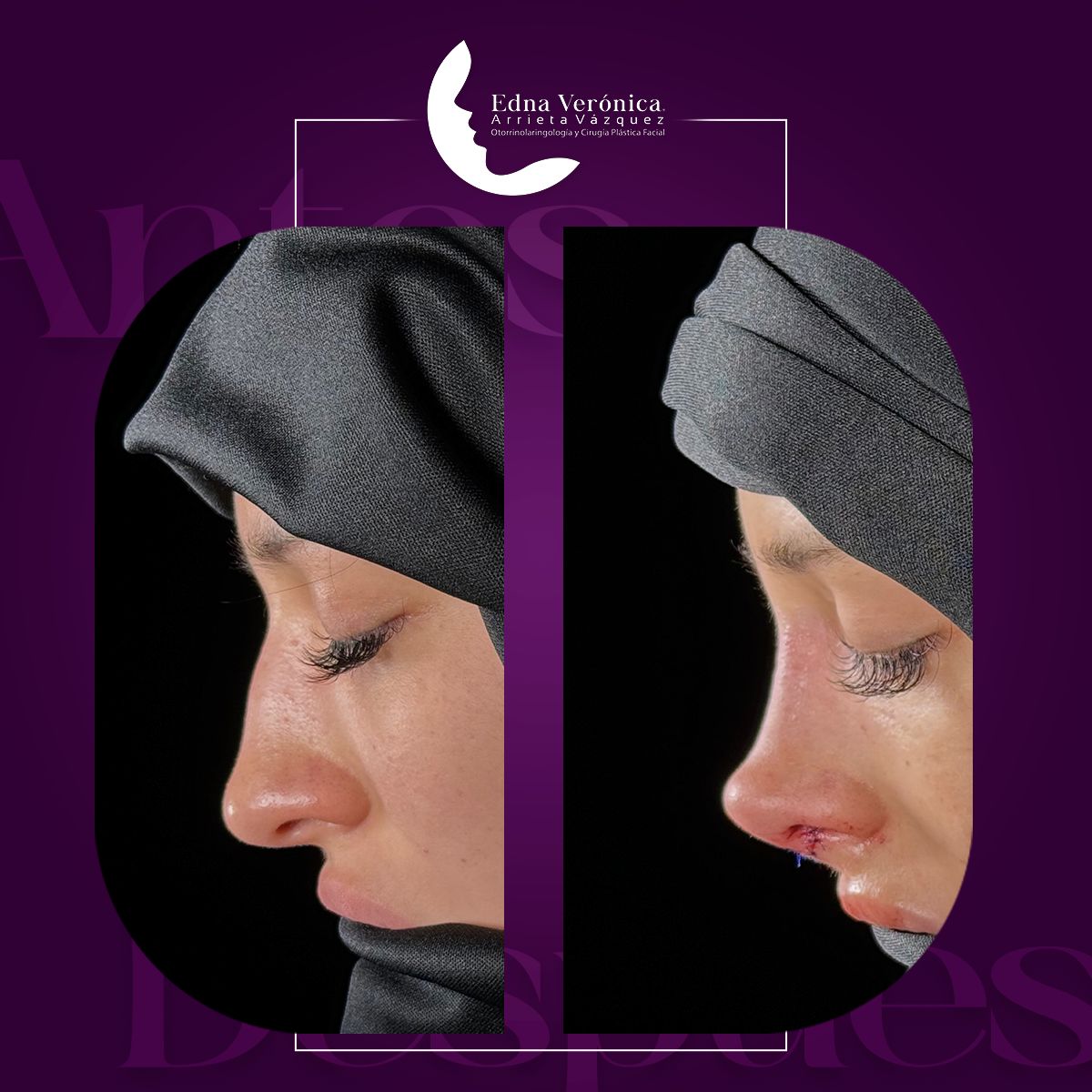 Edna Verónica Arrieta Vázquez-1