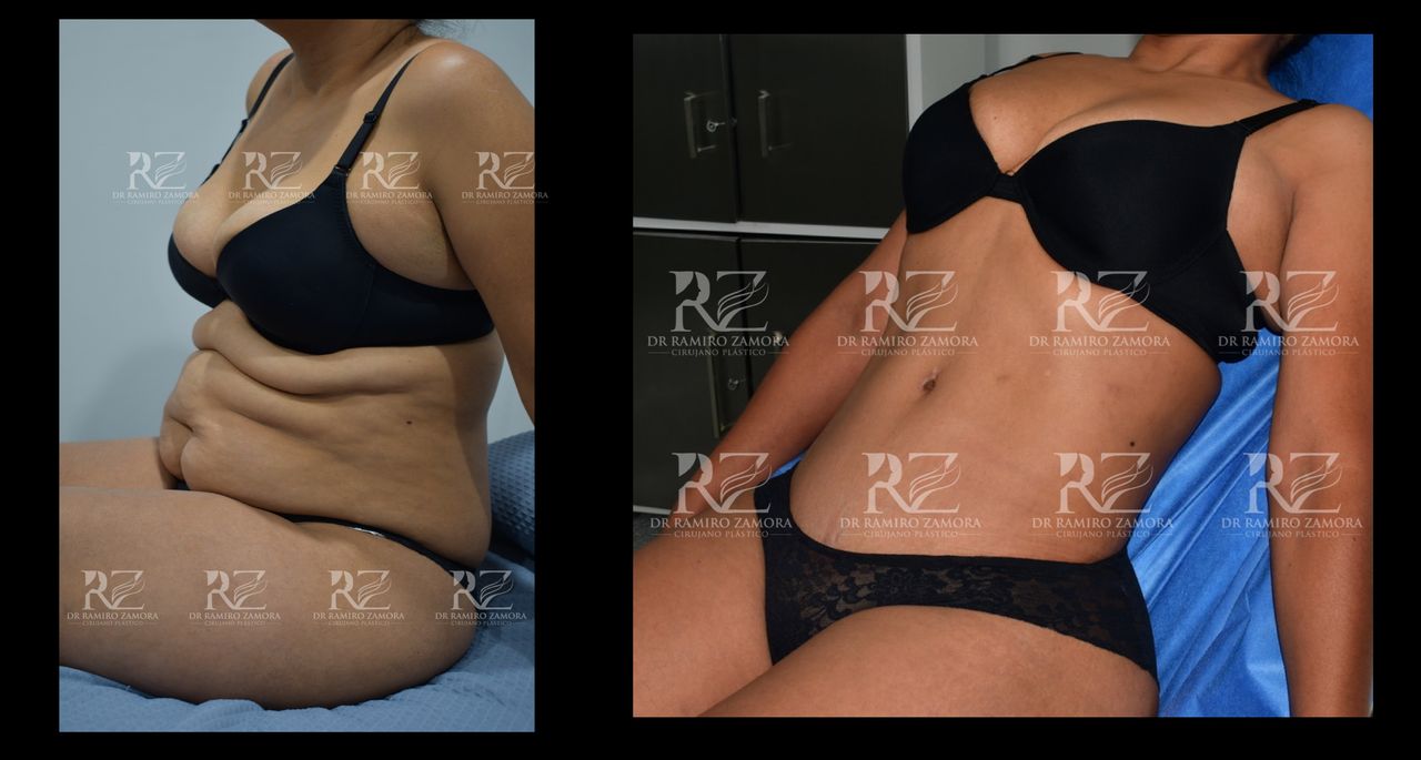 Ramiro Zamora Rodríguez-9