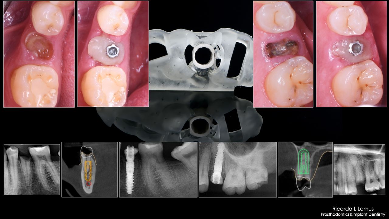 Ricardo López Lemus-127