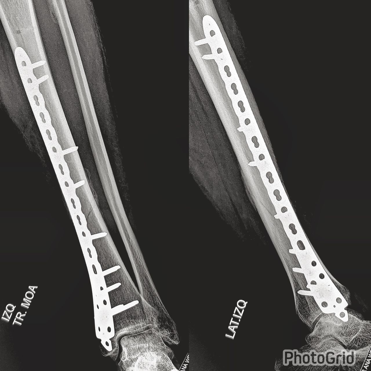 Avelino Aguilar Merlo-9