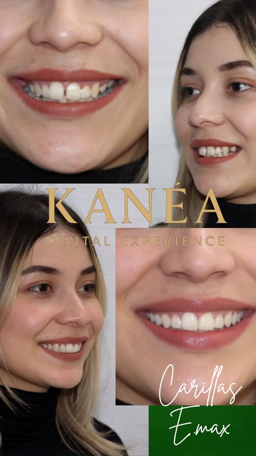 Antonio Hernández Ayala-7