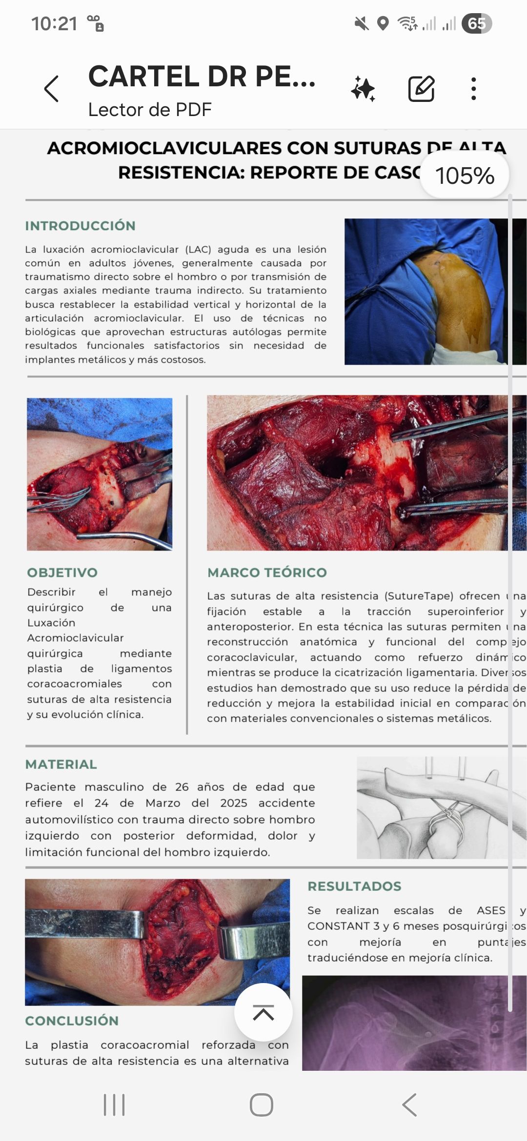 Pedro López Villalva-1