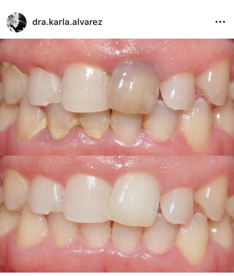 Karla Alvarez Treviño-7