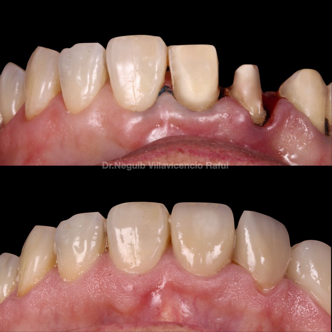 Neguib Villavicencio Raful-47