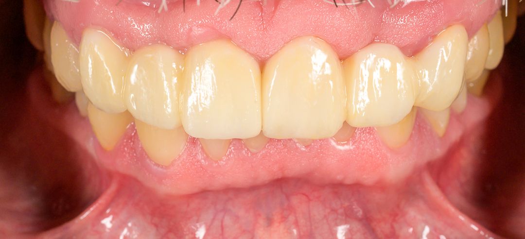 Alam Azael Arrazola González-5