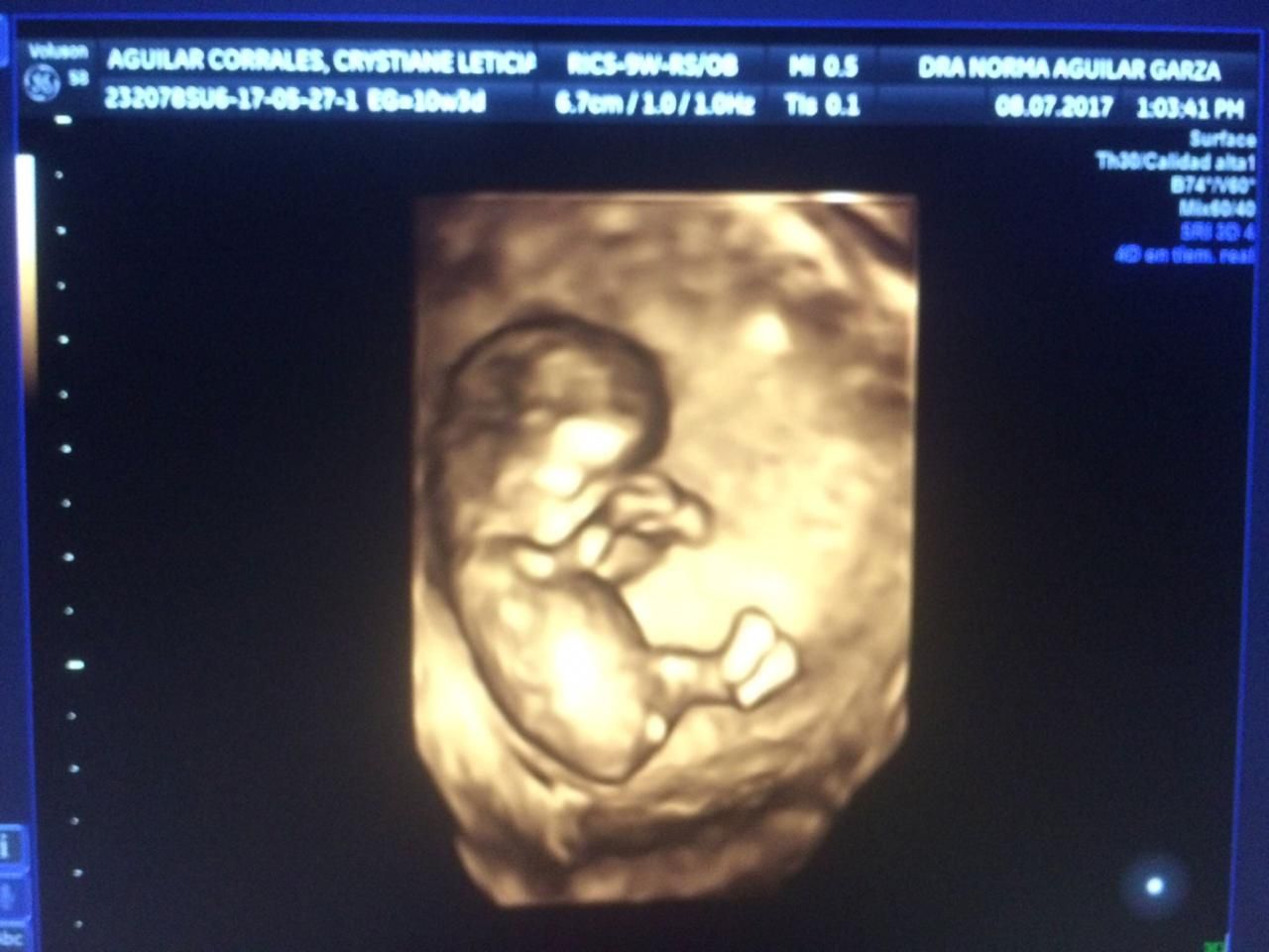 Norma Aguilar Garza-6