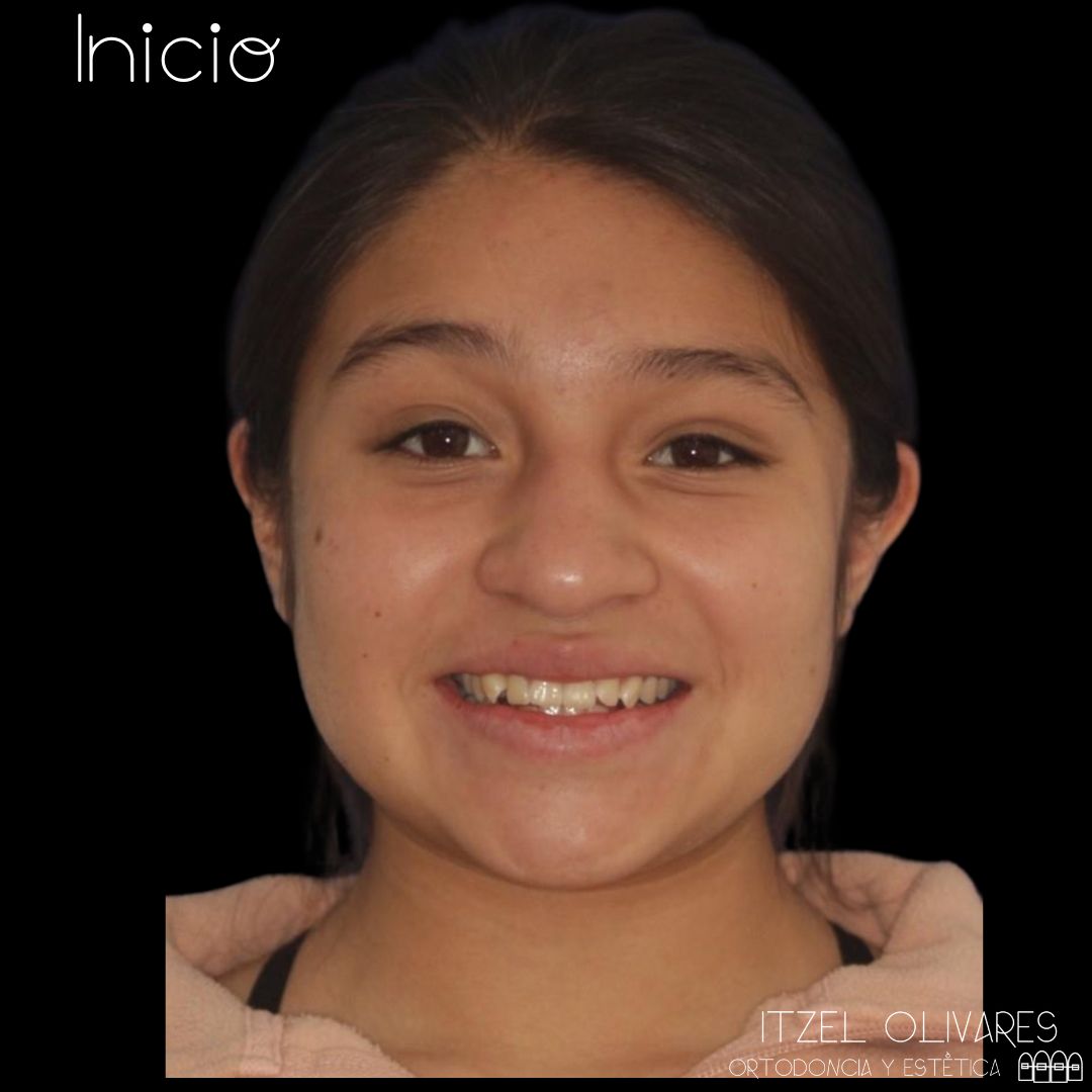 Itzel Olivares Lara-11