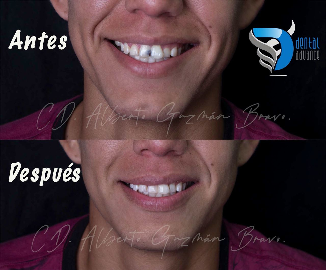 Alberto Guzmán Bravo-10