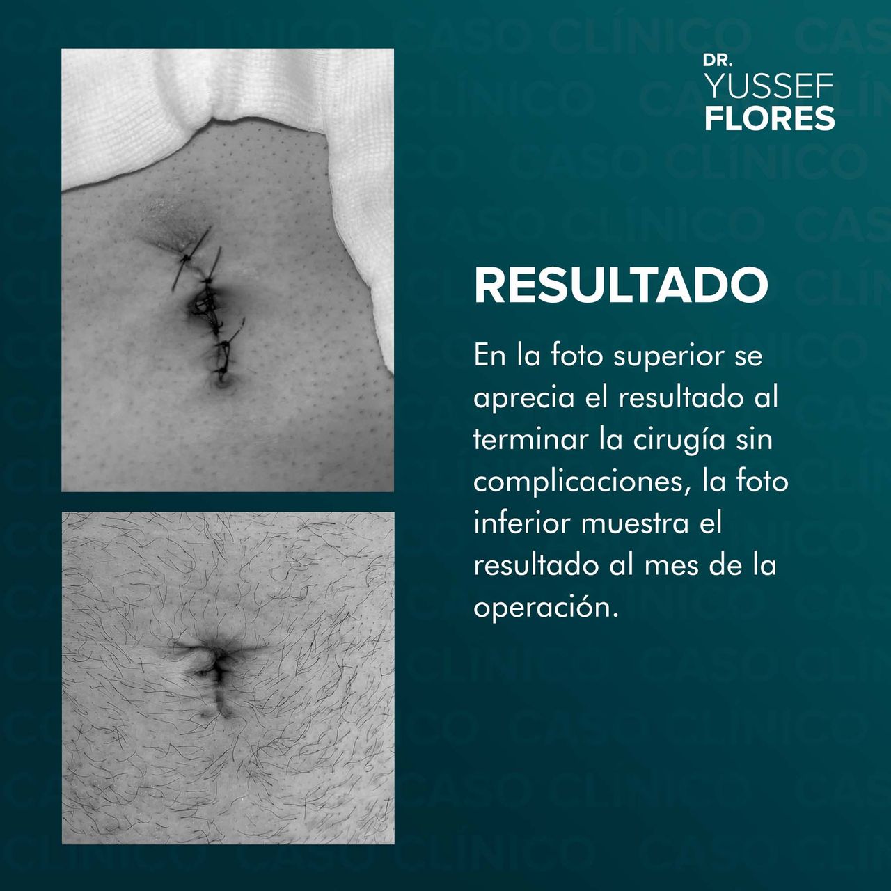 Yussef Flores López-54