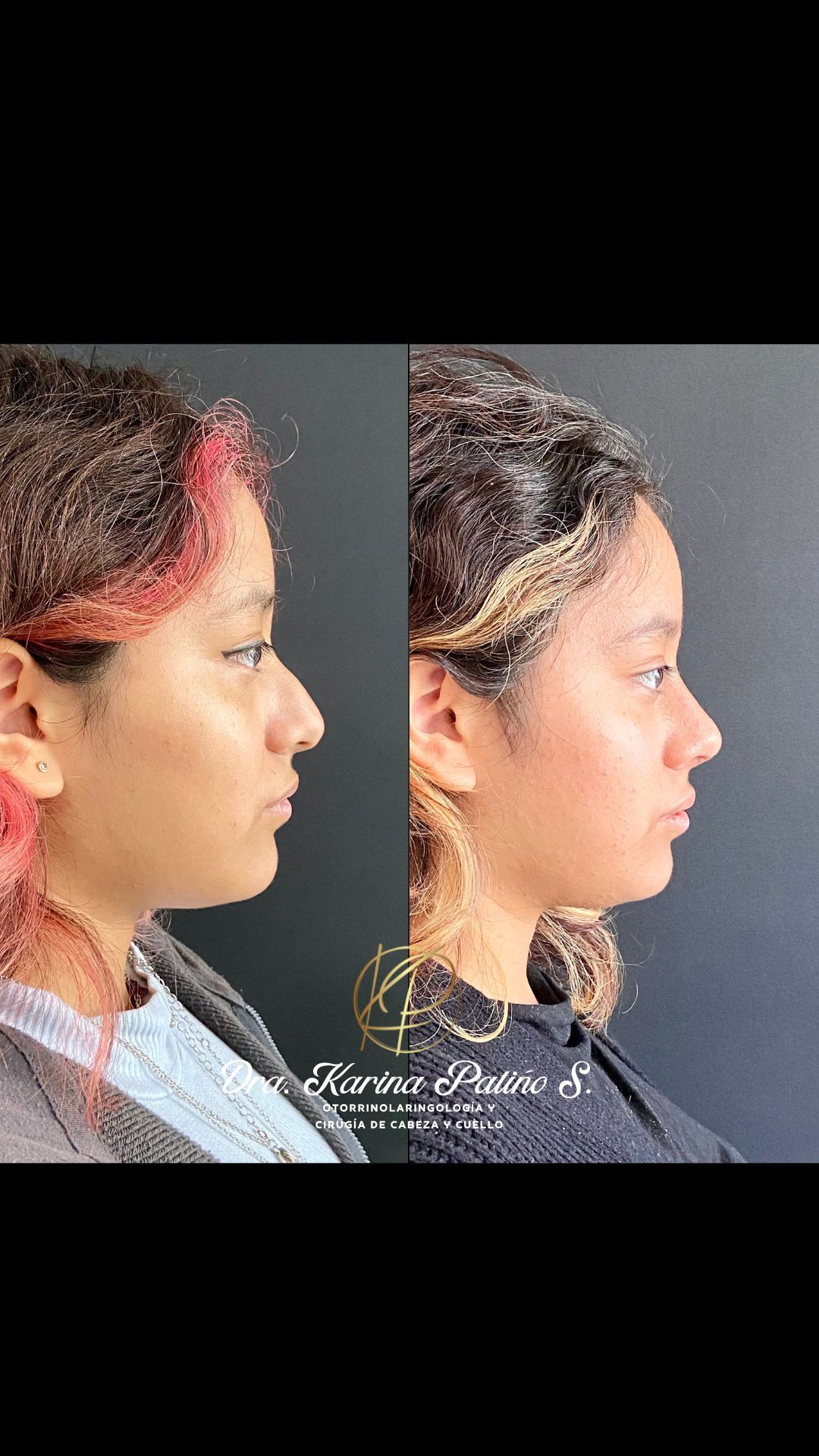 Karina Patiño S.-19