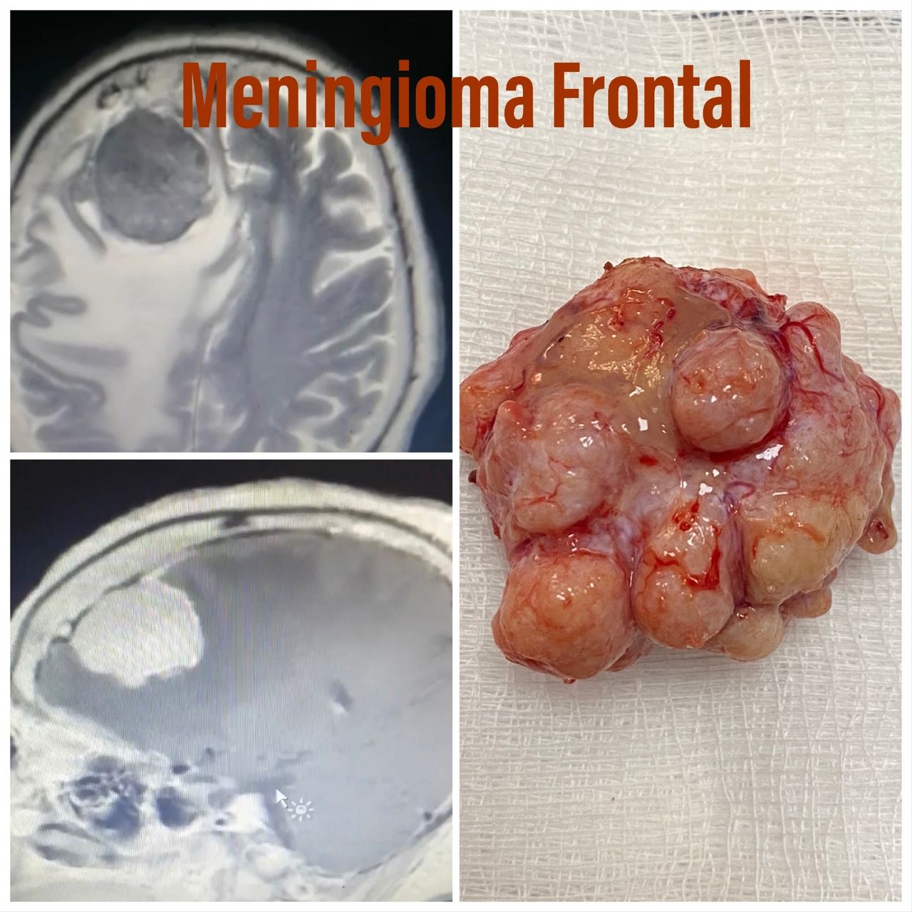 Michelle Omar Calderon Sánchez-11