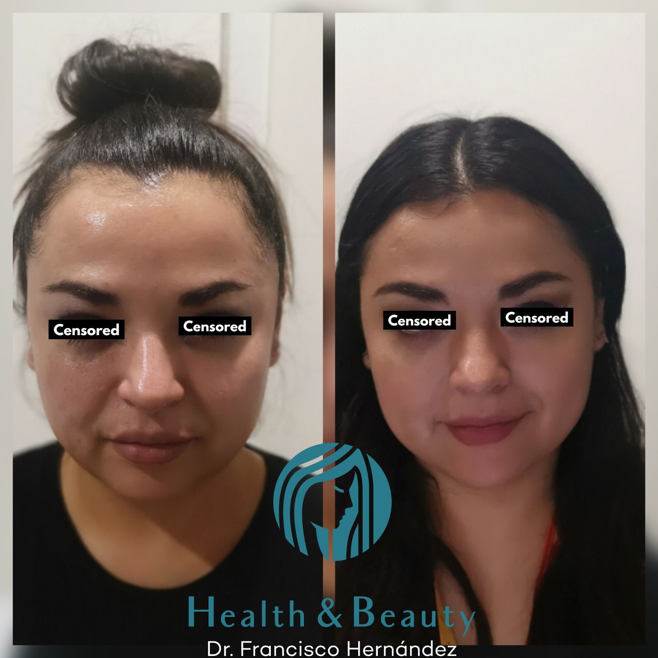 Francisco Hernández Gómez Crespo-178