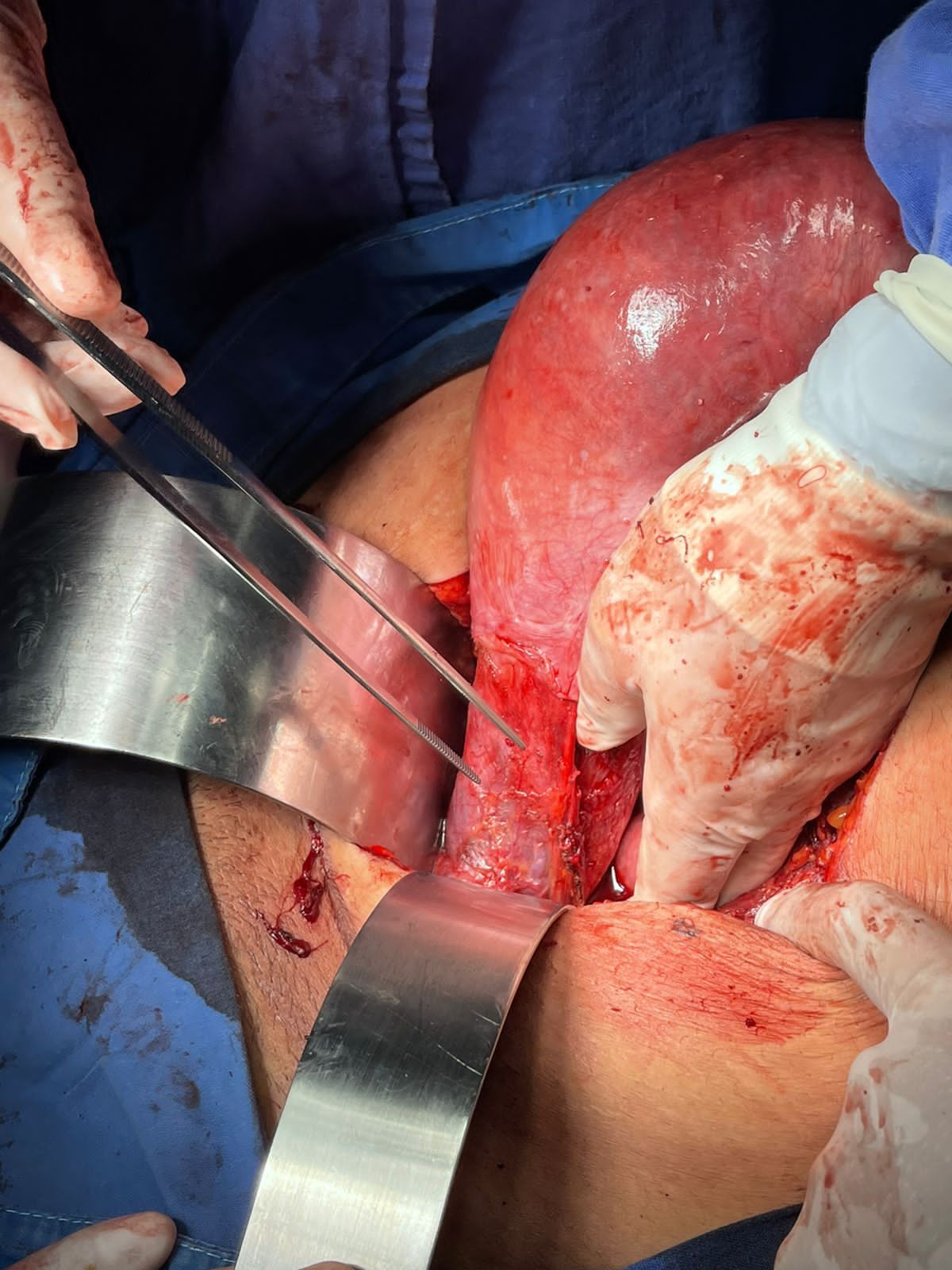 Ángel Millán Juárez-25