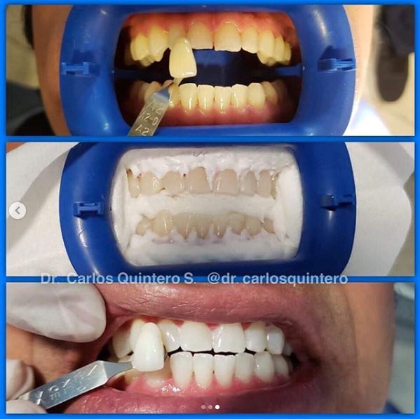 Carlos Quintero Salcedo-12