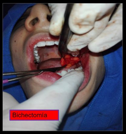 Diana Araceli Dávila Hernández-22