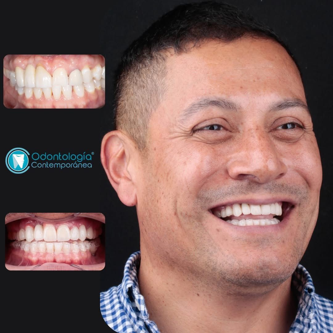 Jorge Robles Castañeda-20