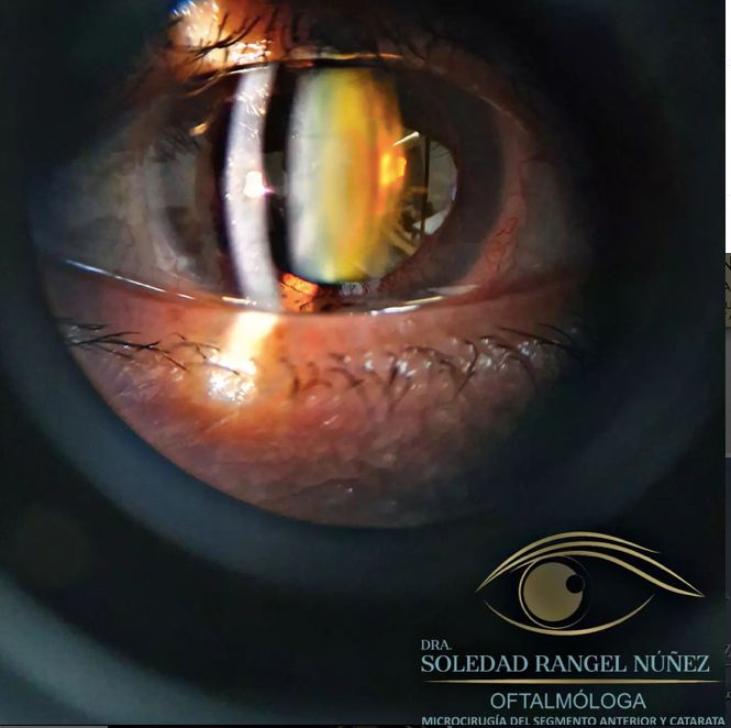 Soledad Rangel Núñez-13