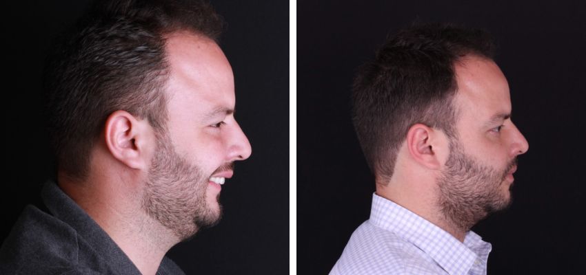 Federico Suastegui Carmona-2