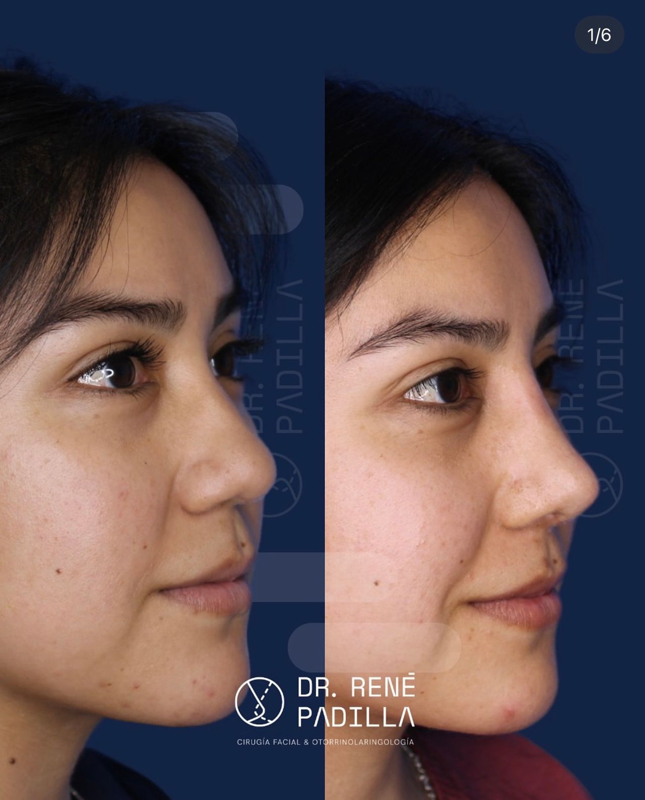 René Emmanuel Padilla López-15