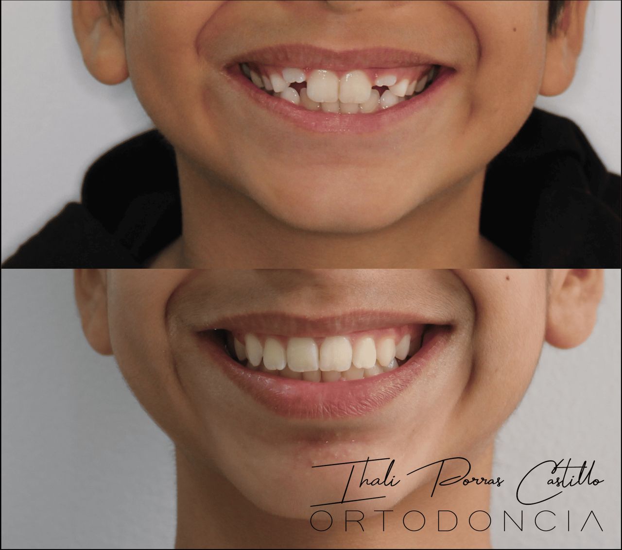 Ihali Porras Castillo-7