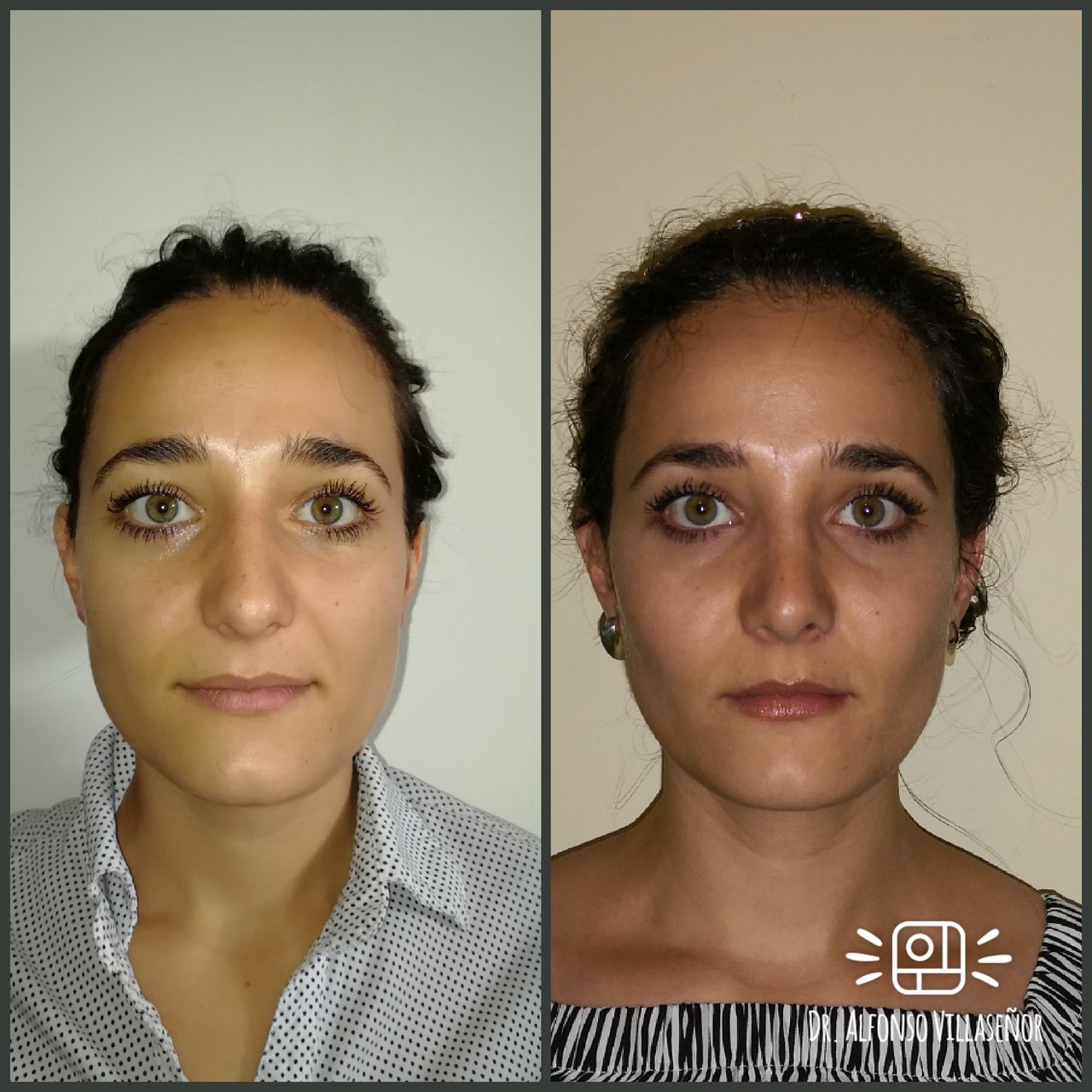 Alfonso Villaseñor Herrero-4