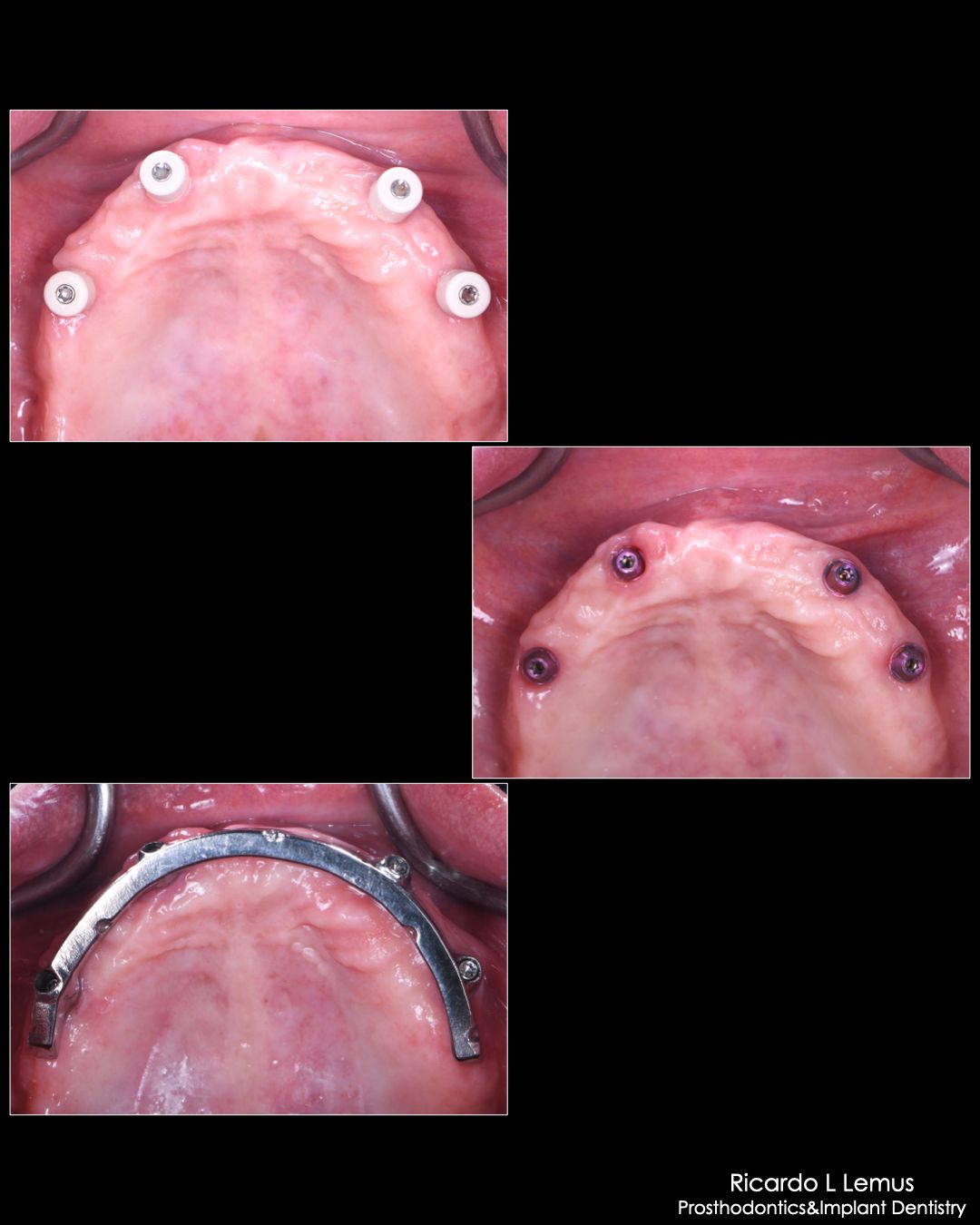 Ricardo López Lemus-105