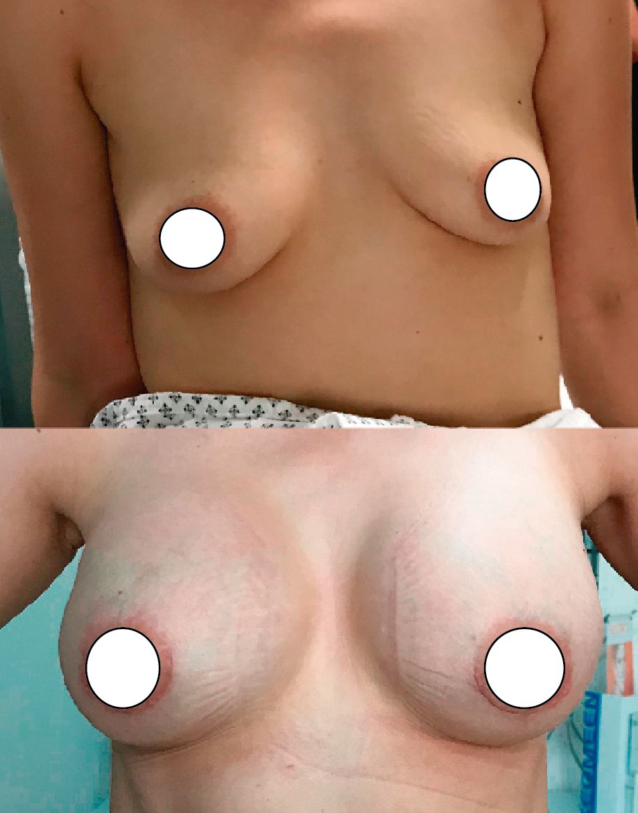 J. Antonio Meré Gómez-3