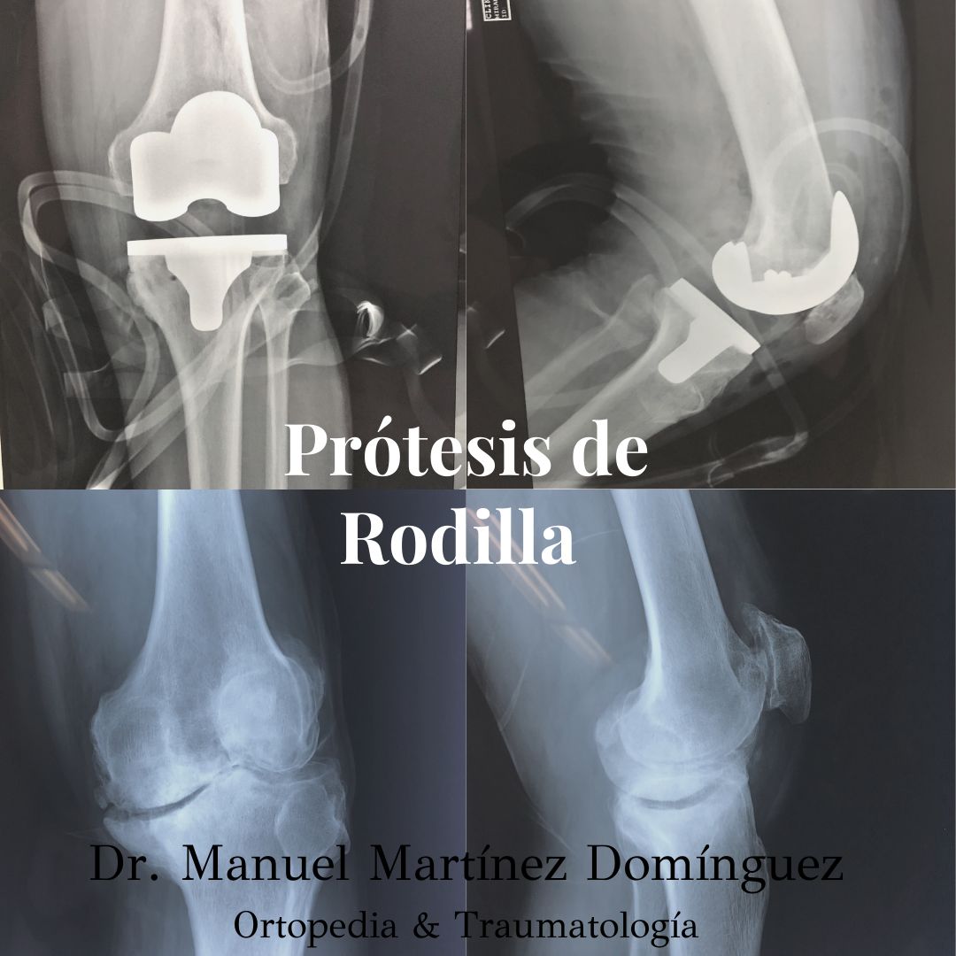 Manuel Martínez Domínguez-6