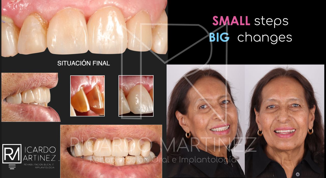 J. Ricardo Martínez-5