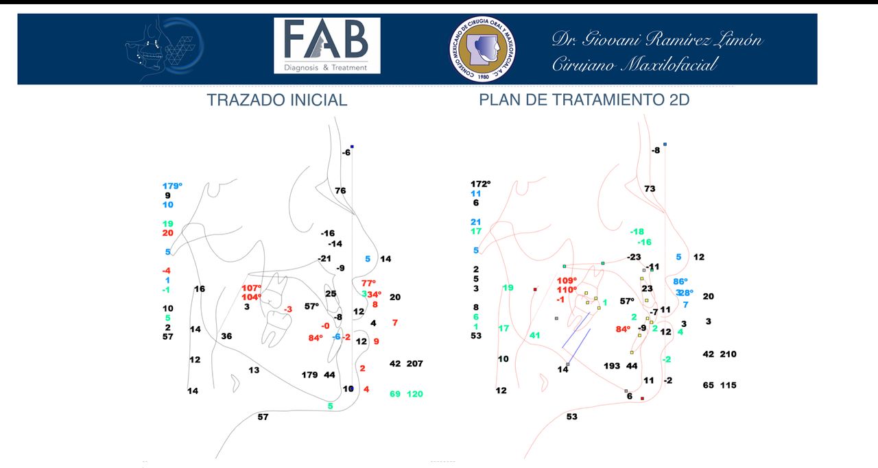 Giovani Ramírez Limón-24