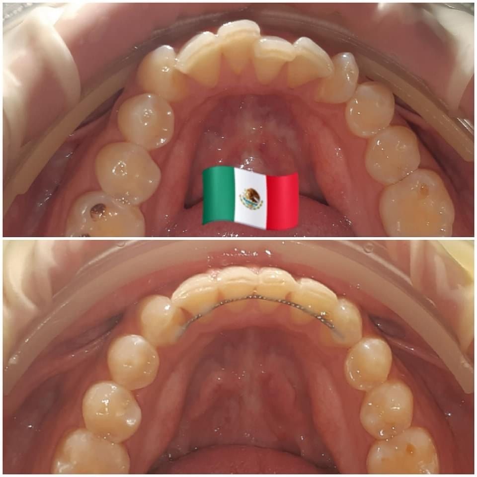 Blanca Margarita Lora Aguilar-0