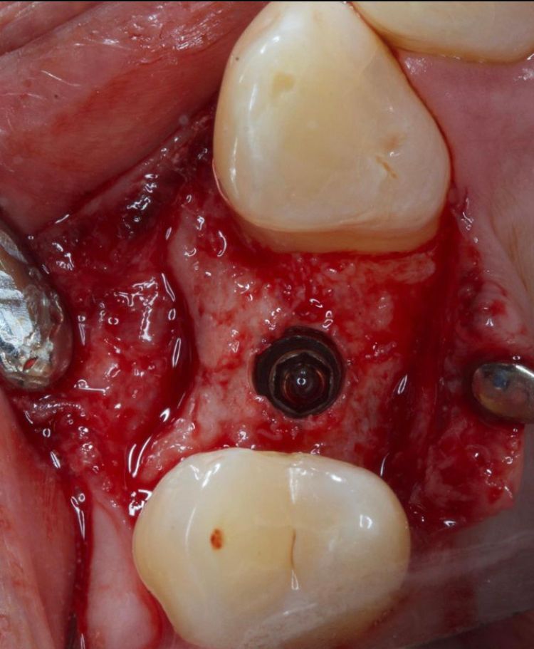 Agustin Salamanca Tapia-24